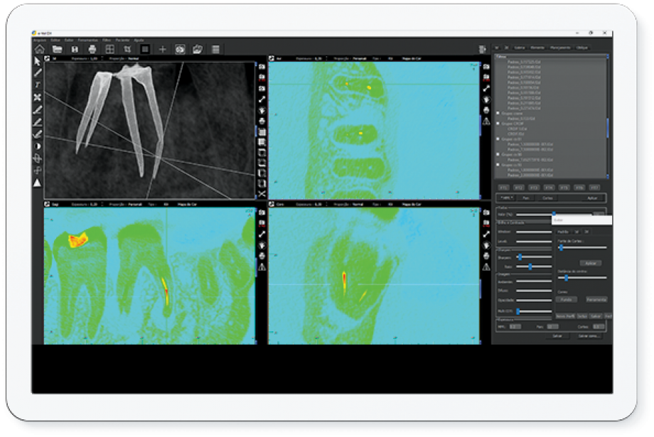 Filtro FI - Fractured Instrument
