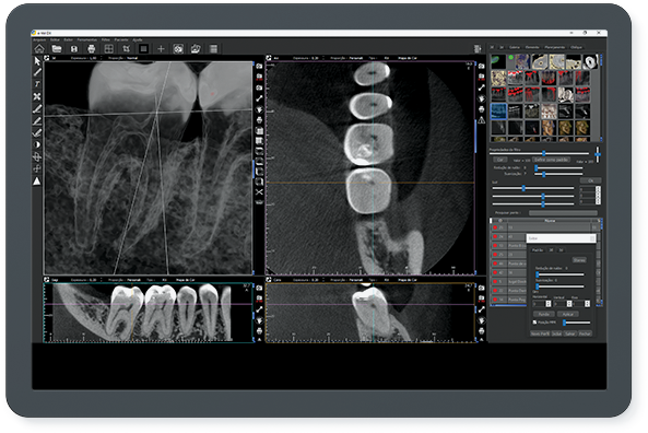 Filtro PH - Pulp Horn
